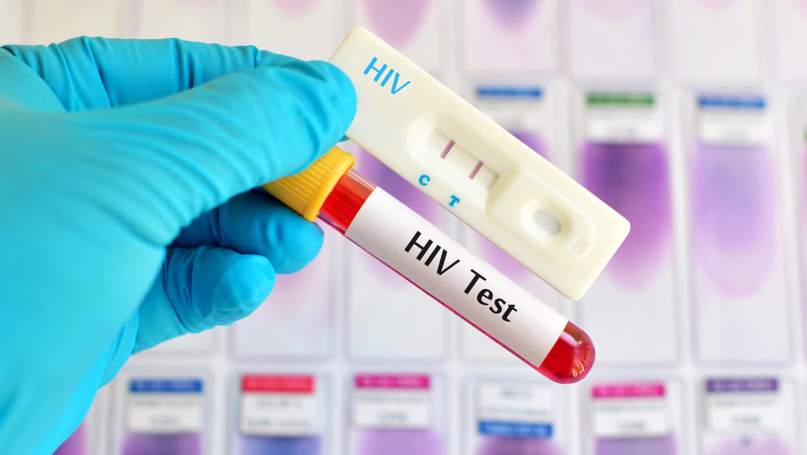 Don't wait to get tested for HIV–get it done.