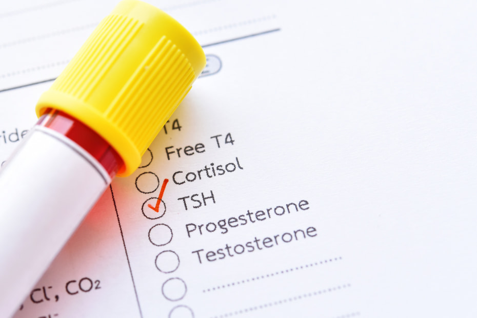 Thyroid hormone test