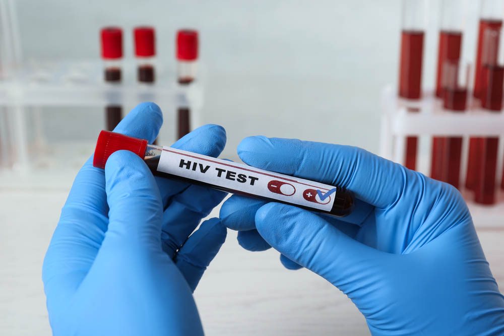 Scientist holding tube with blood sample and label HIV Test at white table, closeup