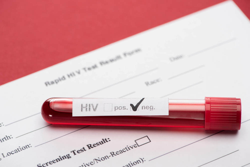 Rapid HIV test result form with negative hiv blood sample test