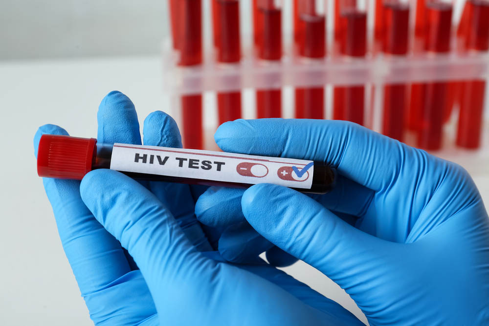 Scientist holding tube with blood sample and label HIV Test at table, closeup