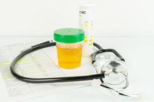 Small can with urinalysis and stethoscope on paper with medical notes