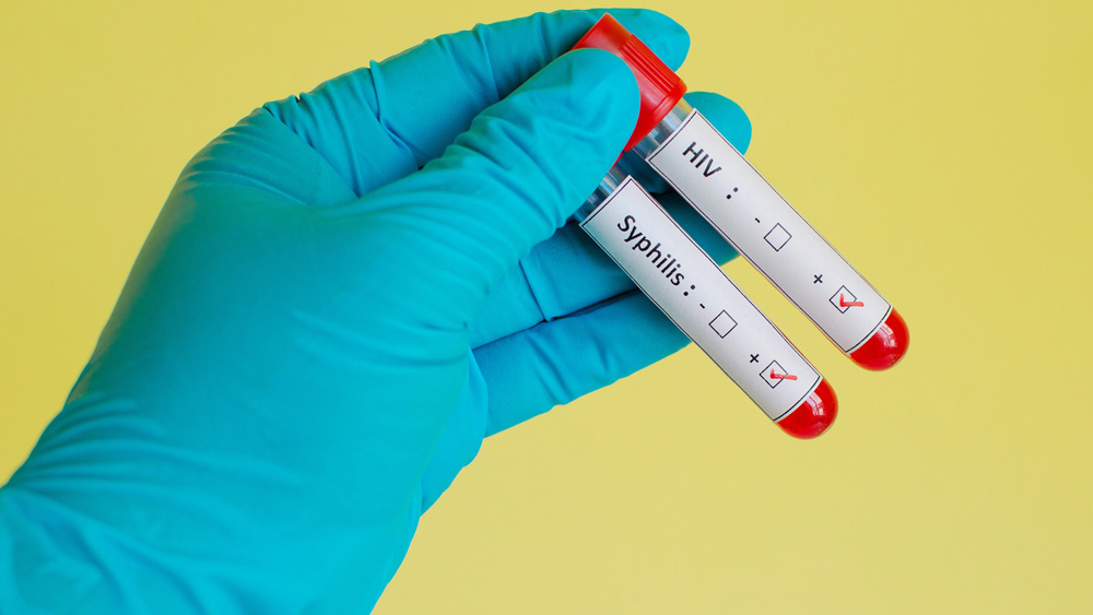 HIV virus, medical concept, Human Immunodeficiency Virus Positive test