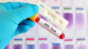HIV virus, medical concept, Human Immunodeficiency Virus Positive test