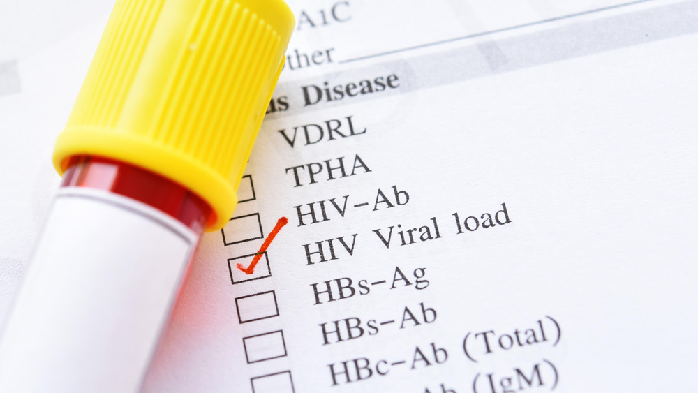 hiv-virus-medical-concept-human-immunodeficiency