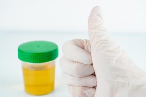 Closeup shot of thumbs up hand in gloves with urinalysis cup background