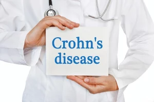 Understanding Crohns Disease Symptoms, Causes, and Treatment -RTTC