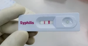 Late Stage Syphilis: All You Need To Know