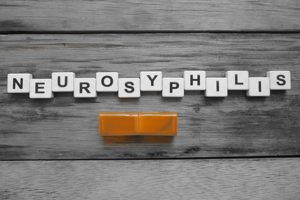 Neurosyphilis - Causes, Symptoms, Diagnosis, and More - RTTC