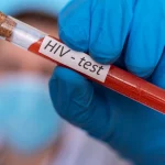 What Happens After an HIV Diagnosis