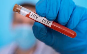 What Happens After an HIV Diagnosis