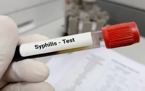 What is Latent Syphilis - RTTC