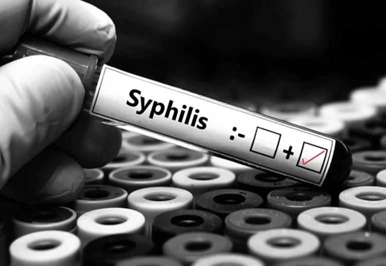 What should you do if you test positive for syphilis - RTTC 