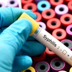 Syphilis Diagnosis